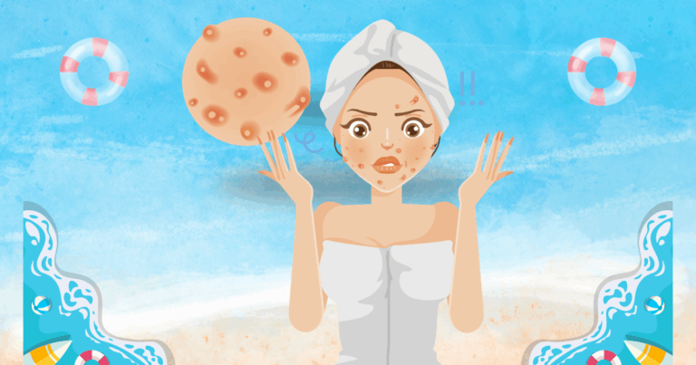 기미 잡티 개선