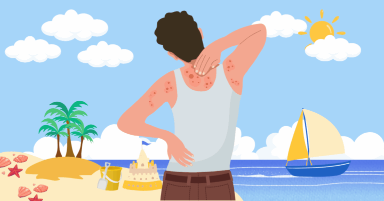 아토피 악화 요인