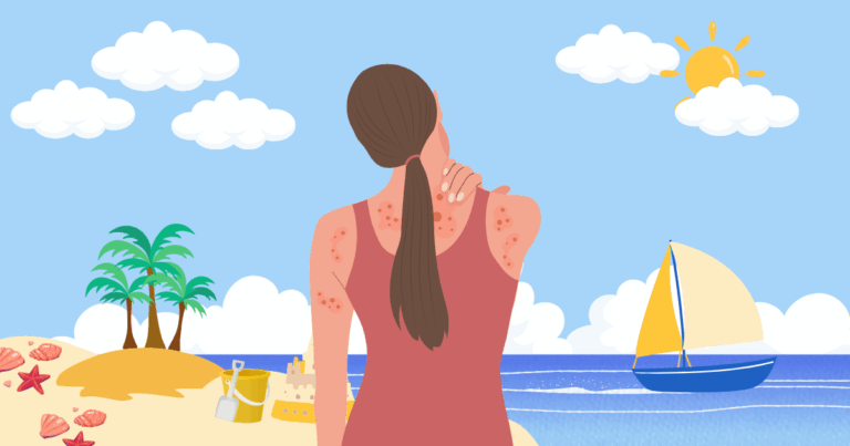 아토피 체질 진단